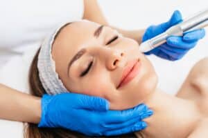 Woman smiling while receiving a refreshing microneedling treatment from her for smoother, firmer skin